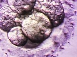 移植前内膜厚能否做内膜微刺激分情况，有没有用一看便知